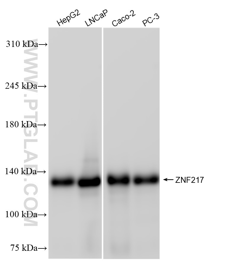 Western Blot (WB) analysis of various lysates using ZNF217 Recombinant antibody (84276-1-RR)