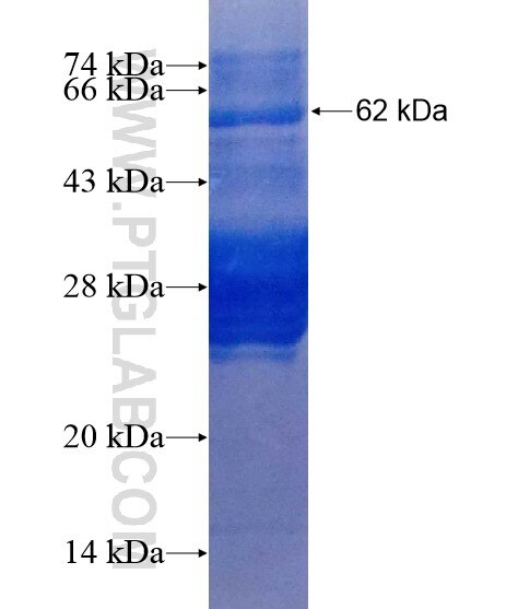 ZNF217 fusion protein Ag19453 SDS-PAGE