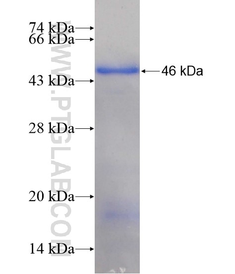 ZNF217 fusion protein Ag19468 SDS-PAGE