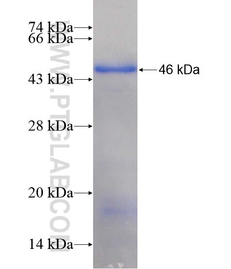 ZNF217 fusion protein Ag19468 SDS-PAGE