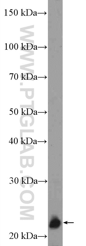 Western Blot (WB) analysis of Jurkat cells using ZNF22 Polyclonal antibody (17063-1-AP)