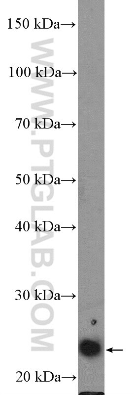 Western Blot (WB) analysis of Jurkat cells using ZNF22 Polyclonal antibody (17063-1-AP)