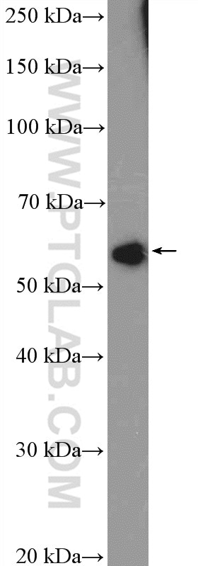 Western Blot (WB) analysis of HeLa cells using ZNF232 Polyclonal antibody (21467-1-AP)