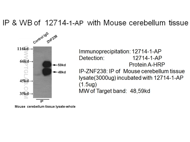 Immunoprecipitation (IP) experiment of mouse cerebellum tissue using ZNF238 Polyclonal antibody (12714-1-AP)