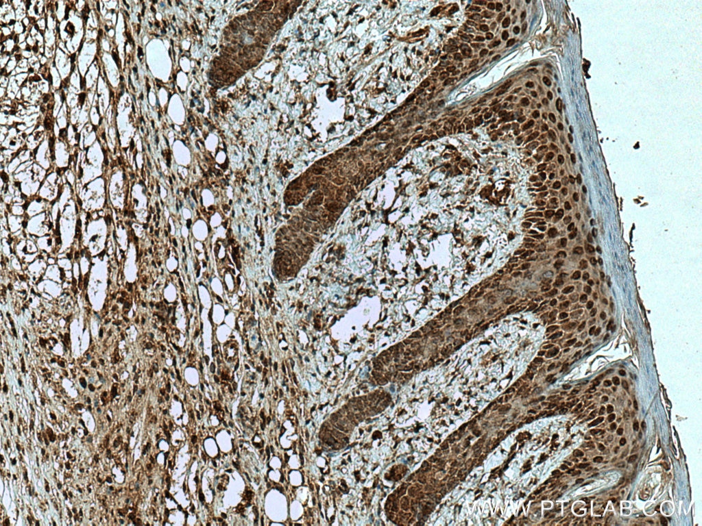 Immunohistochemistry (IHC) staining of mouse skin tissue using ZNF238 Polyclonal antibody (12714-1-AP)