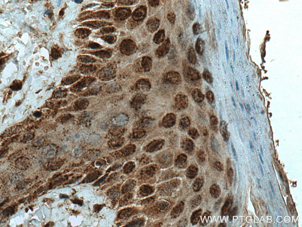 Immunohistochemistry (IHC) staining of mouse skin tissue using ZNF238 Polyclonal antibody (12714-1-AP)