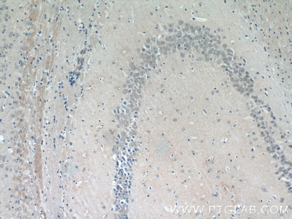 Immunohistochemistry (IHC) staining of mouse brain tissue using ZNF238 Polyclonal antibody (12714-1-AP)