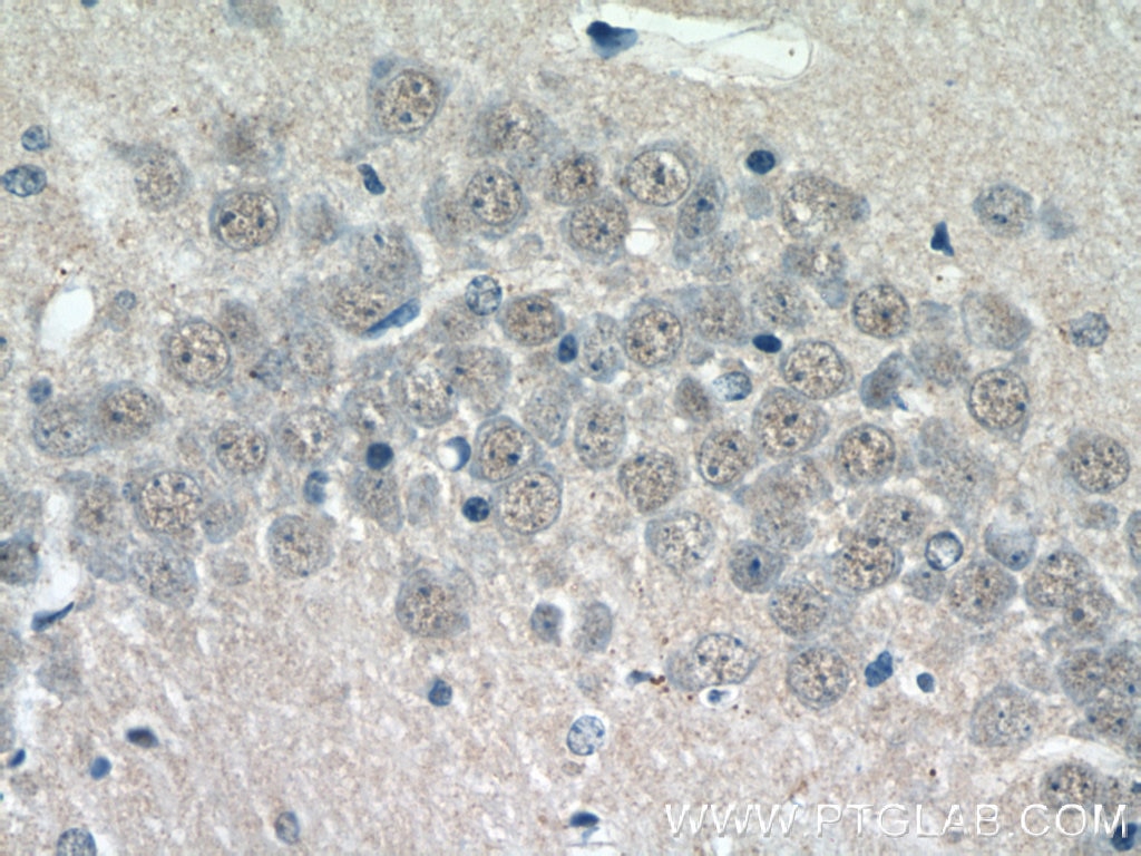 Immunohistochemistry (IHC) staining of mouse brain tissue using ZNF238 Polyclonal antibody (12714-1-AP)