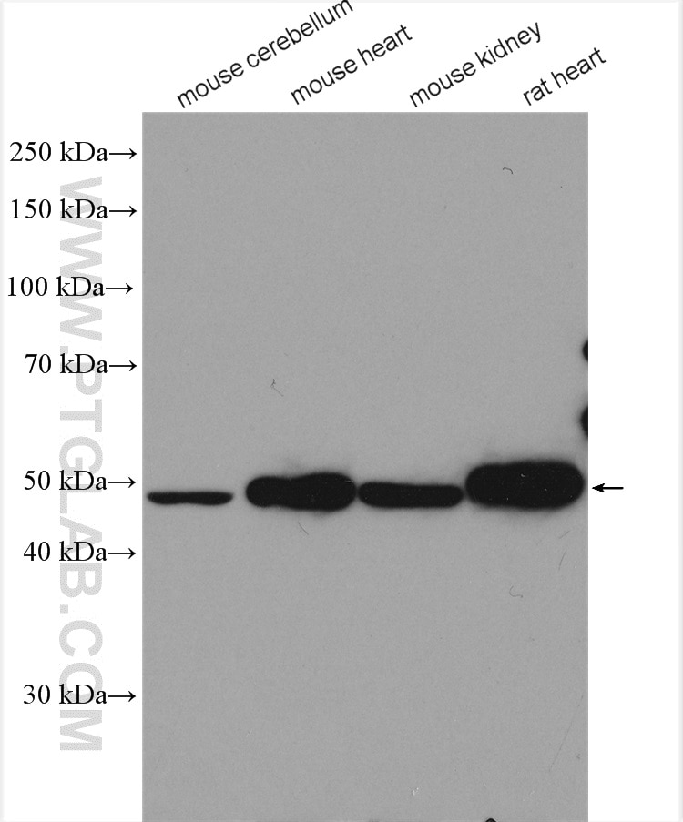 Western Blot (WB) analysis of various lysates using ZNF238/ZBTB18 Polyclonal antibody (12714-1-AP)