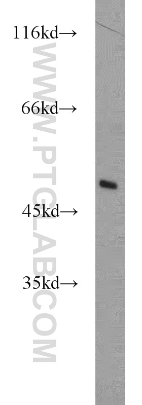 Western Blot (WB) analysis of mouse brain tissue using ZNF238 Polyclonal antibody (12714-1-AP)