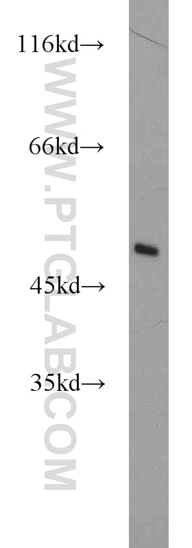 WB analysis of mouse brain using 12714-1-AP