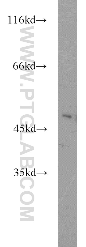 Western Blot (WB) analysis of mouse brain tissue using ZNF238 Polyclonal antibody (12714-1-AP)