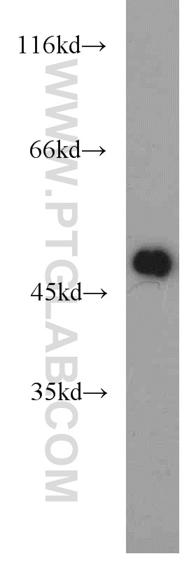 Western Blot (WB) analysis of mouse brain tissue using ZNF238 Polyclonal antibody (12714-1-AP)