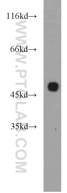 Western Blot (WB) analysis of mouse kidney tissue using ZNF238 Polyclonal antibody (12714-1-AP)