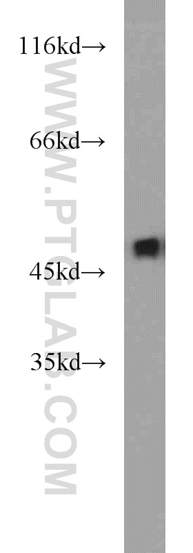 Western Blot (WB) analysis of mouse kidney tissue using ZNF238 Polyclonal antibody (12714-1-AP)