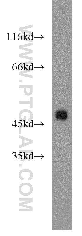 Western Blot (WB) analysis of mouse heart tissue using ZNF238 Polyclonal antibody (12714-1-AP)