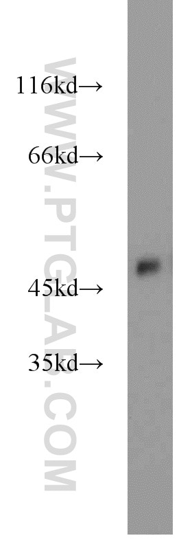 Western Blot (WB) analysis of mouse heart tissue using ZNF238 Polyclonal antibody (12714-1-AP)