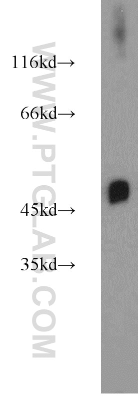 Western Blot (WB) analysis of mouse heart tissue using ZNF238 Polyclonal antibody (12714-1-AP)