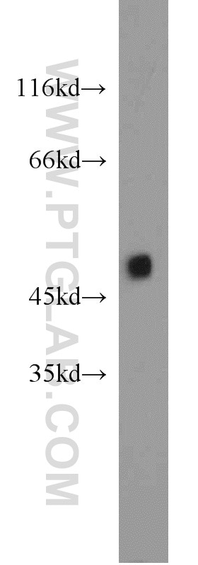 Western Blot (WB) analysis of mouse heart tissue using ZNF238 Polyclonal antibody (12714-1-AP)