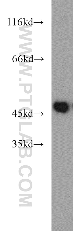 Western Blot (WB) analysis of mouse heart tissue using ZNF238 Polyclonal antibody (12714-1-AP)