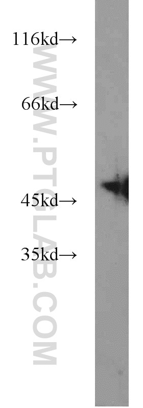 Western Blot (WB) analysis of mouse heart tissue using ZNF238 Polyclonal antibody (12714-1-AP)