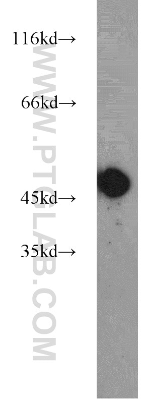Western Blot (WB) analysis of mouse heart tissue using ZNF238 Polyclonal antibody (12714-1-AP)