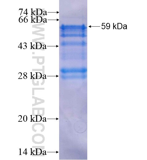 ZNF238 fusion protein Ag3406 SDS-PAGE