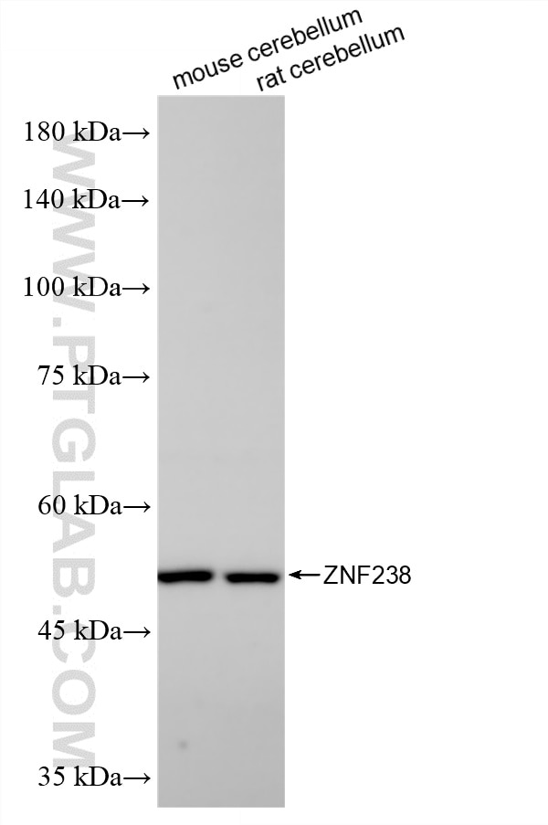 Western Blot (WB) analysis of various lysates using ZNF238/ZBTB18 Recombinant antibody (86544-3-RR)