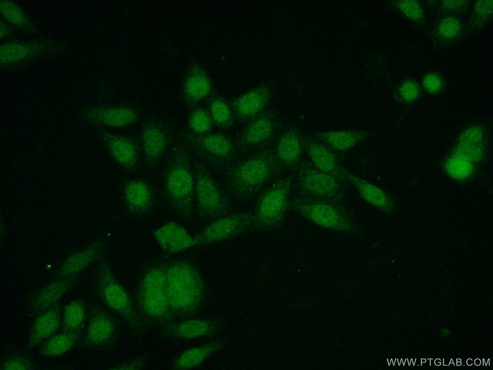 Immunofluorescence (IF) / fluorescent staining of HeLa cells using ZNF24 Polyclonal antibody (11219-1-AP)