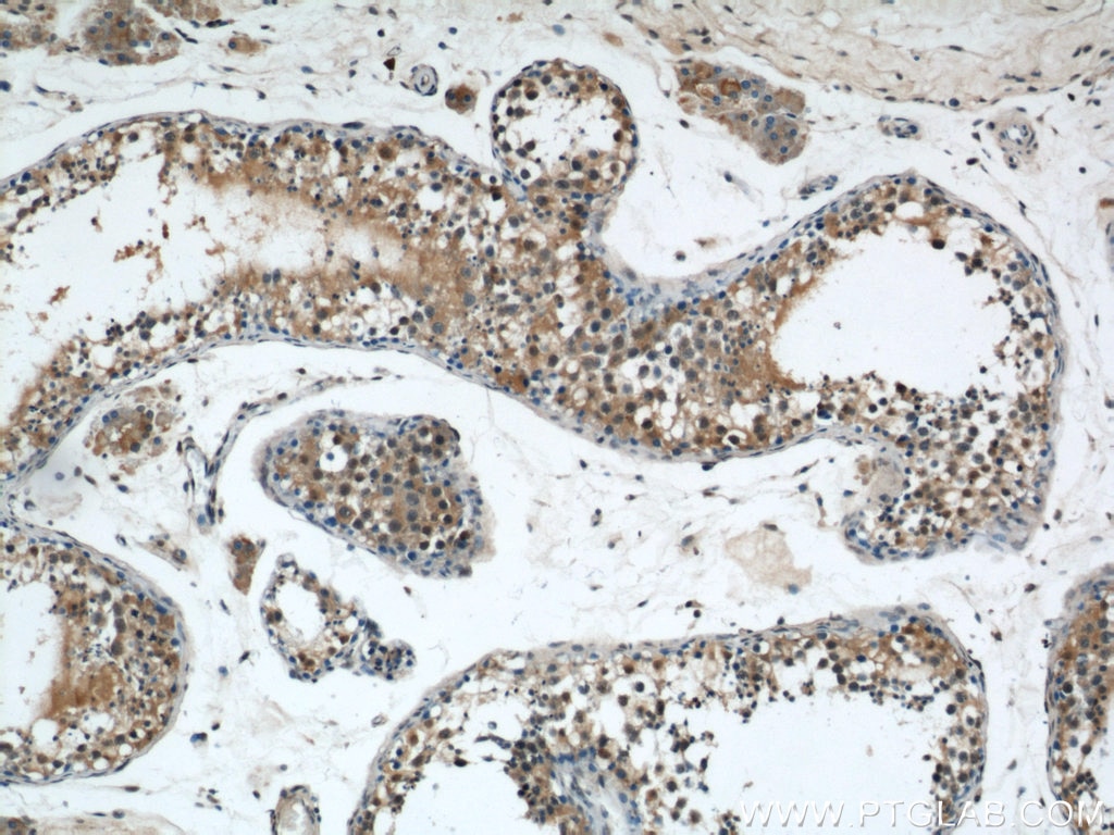 Immunohistochemistry (IHC) staining of human testis tissue using ZNF24 Polyclonal antibody (11219-1-AP)