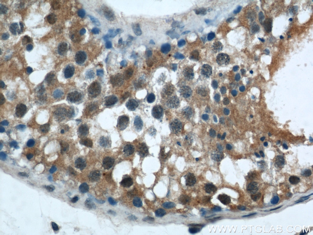 Immunohistochemistry (IHC) staining of human testis tissue using ZNF24 Polyclonal antibody (11219-1-AP)