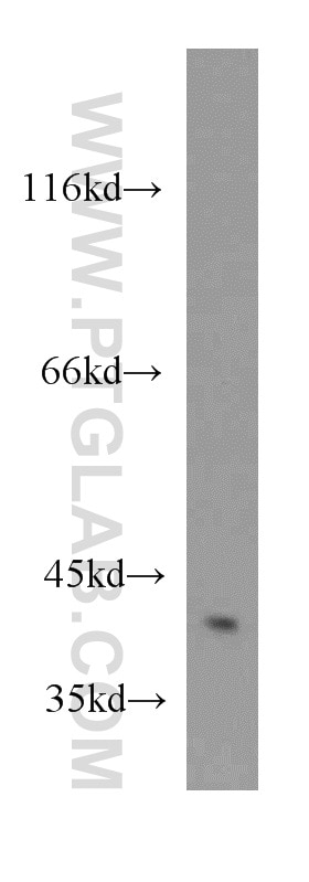 Western Blot (WB) analysis of HeLa cells using ZNF24 Polyclonal antibody (11219-1-AP)