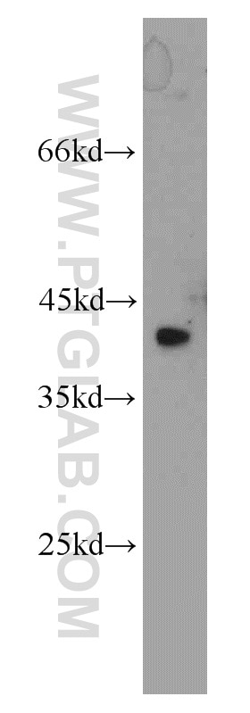Western Blot (WB) analysis of HeLa cells using ZNF24 Polyclonal antibody (11219-1-AP)