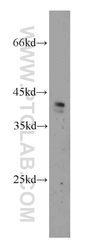 Western Blot (WB) analysis of mouse liver tissue using ZNF24 Polyclonal antibody (11219-1-AP)