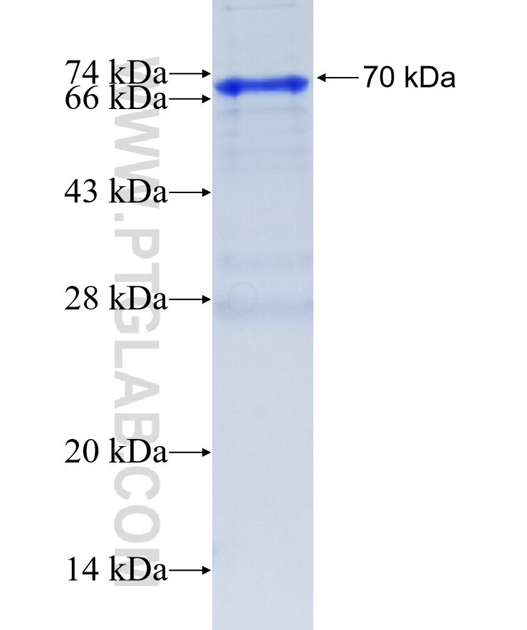 ZNF24 fusion protein Ag1724 SDS-PAGE