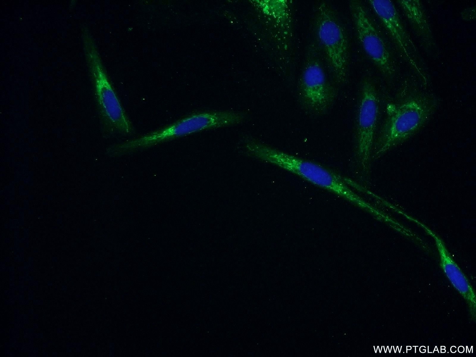 Immunofluorescence (IF) / fluorescent staining of SKOV-3 cells using ZNF251 Polyclonal antibody (25601-1-AP)