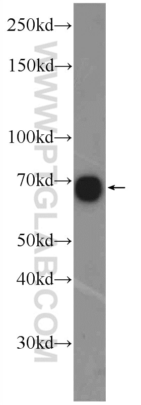 Western Blot (WB) analysis of HepG2 cells using ZNF251 Polyclonal antibody (25601-1-AP)