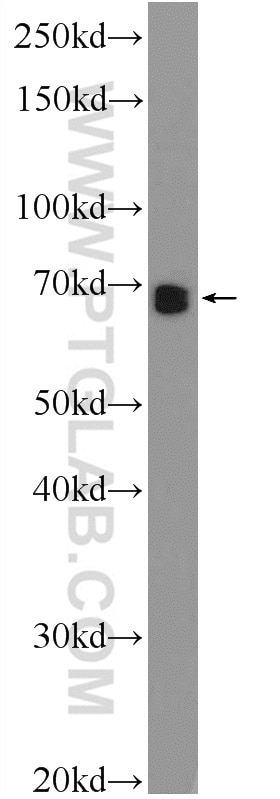 Western Blot (WB) analysis of SKOV-3 cells using ZNF251 Polyclonal antibody (25601-1-AP)