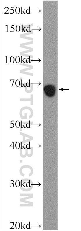 Western Blot (WB) analysis of mouse testis tissue using ZNF251 Polyclonal antibody (25601-1-AP)
