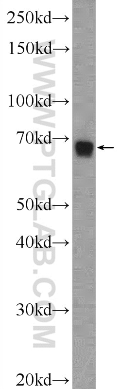 Western Blot (WB) analysis of mouse skeletal muscle tissue using ZNF251 Polyclonal antibody (25601-1-AP)