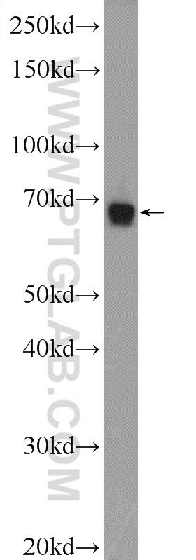 Western Blot (WB) analysis of mouse skeletal muscle tissue using ZNF251 Polyclonal antibody (25601-1-AP)