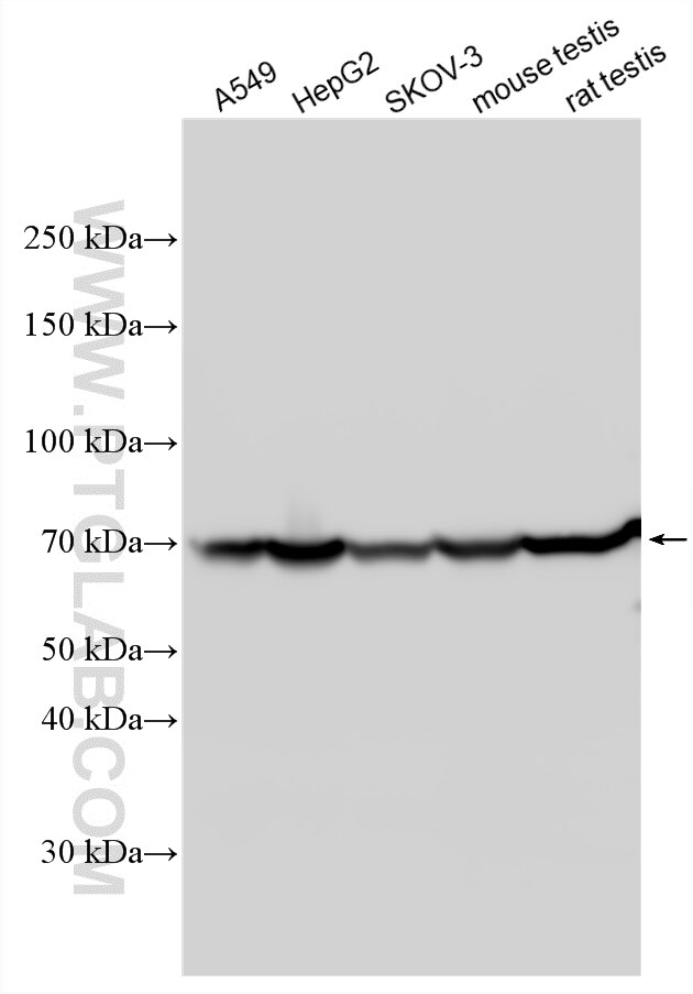 Western Blot (WB) analysis of various lysates using ZNF251 Polyclonal antibody (25601-1-AP)