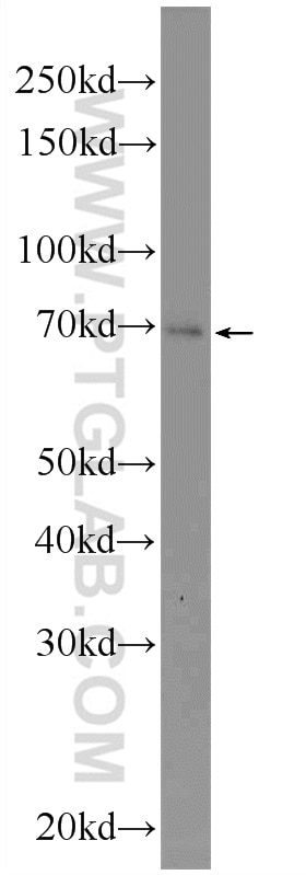 Western Blot (WB) analysis of SMMC-7721 cells using ZNF253 Polyclonal antibody (25152-1-AP)