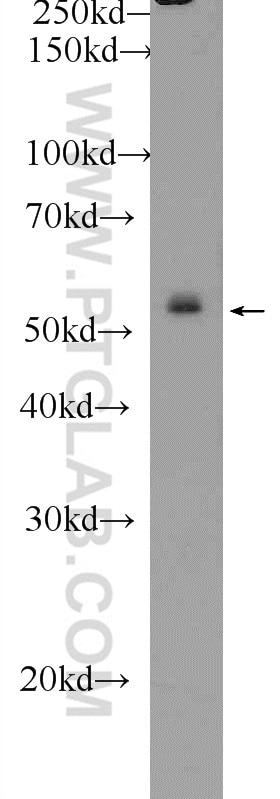 Western Blot (WB) analysis of HepG2 cells using ZNF253 Polyclonal antibody (25152-1-AP)