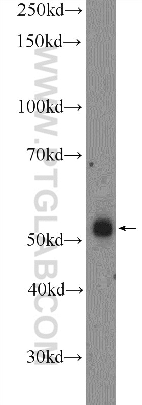 Western Blot (WB) analysis of mouse testis tissue using ZNF256 Polyclonal antibody (10360-1-AP)