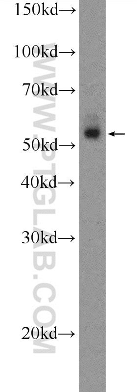 Western Blot (WB) analysis of HL-60 cells using ZNF256 Polyclonal antibody (10360-1-AP)