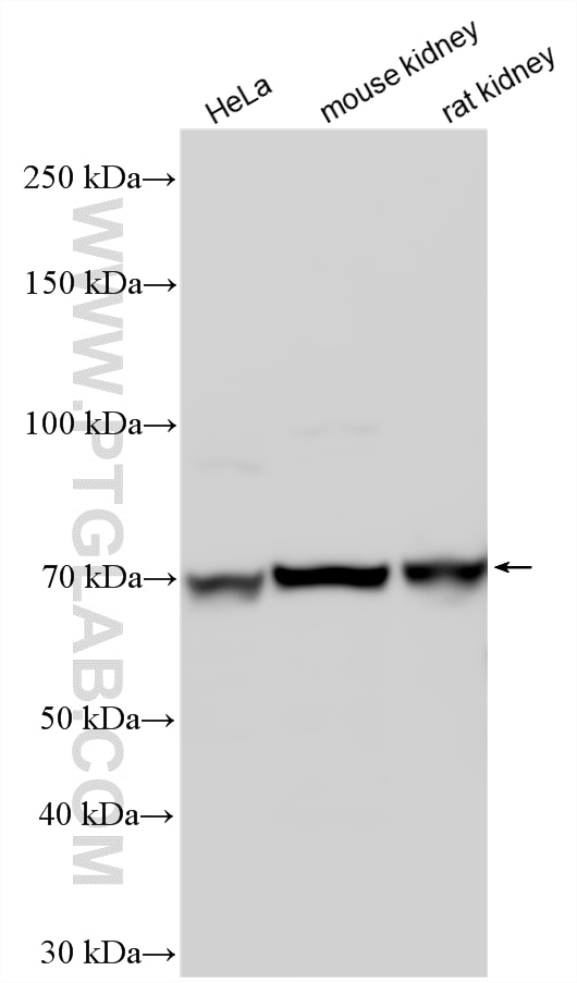 Western Blot (WB) analysis of various lysates using ZNF256 Polyclonal antibody (10360-1-AP)