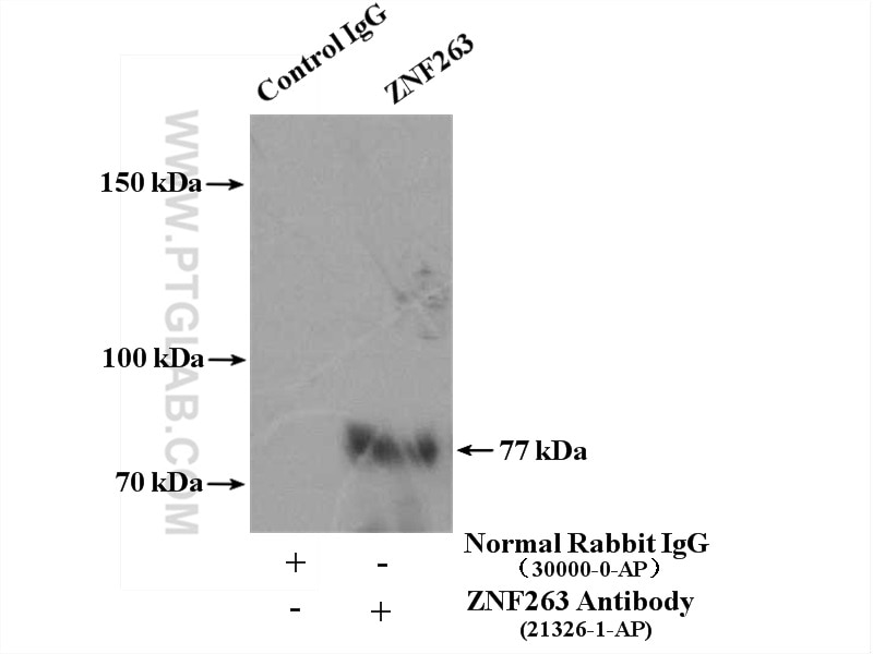 Immunoprecipitation (IP) experiment of HepG2 cells using ZNF263 Polyclonal antibody (21326-1-AP)