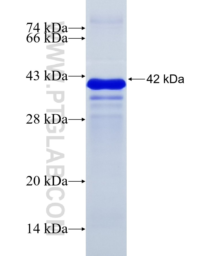 ZNF263 fusion protein Ag15158 SDS-PAGE
