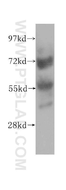 Western Blot (WB) analysis of HeLa cells using ZNF266 Polyclonal antibody (11374-1-AP)